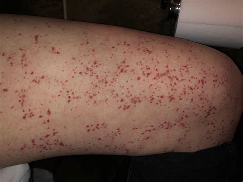 red blotches on skin
